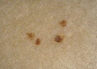 stain removal owlet carpet care